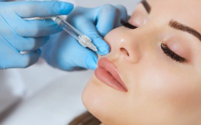 Prep Your Smile For Lip Fillers