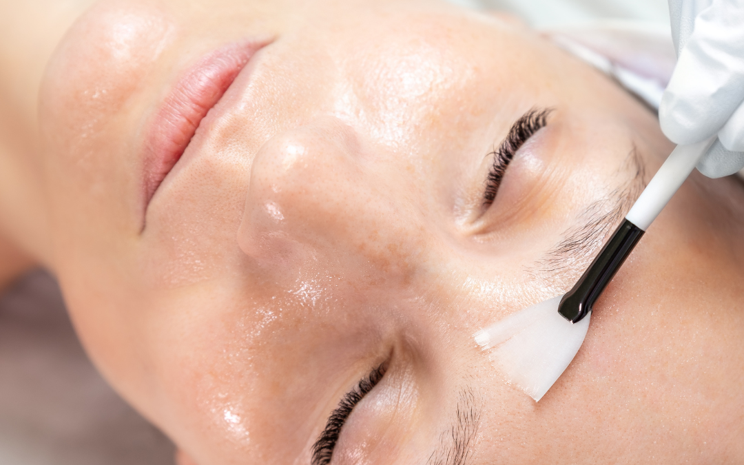 The Science Behind Chemical Peels: Understanding Acid Therapy for Skin Rejuvenation